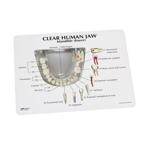 Image of 3B Scientific Clear Human Jaw with teeth model