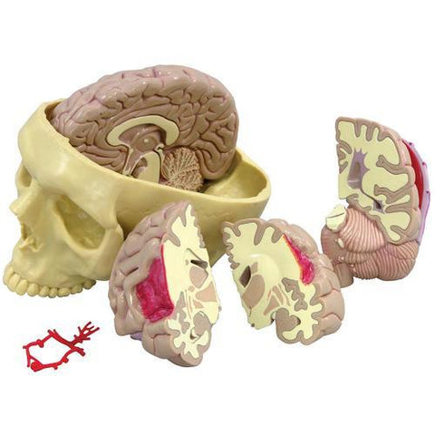 Image of 3B Scientific Brain Model