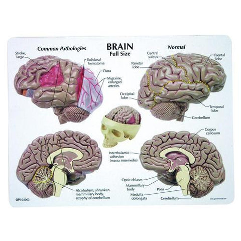 Image of 3B Scientific Brain Model