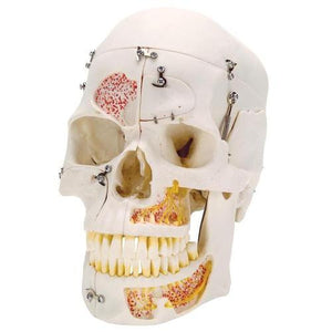 3B Scientific Deluxe Human Demonstration Dental Skull Model, 10 part