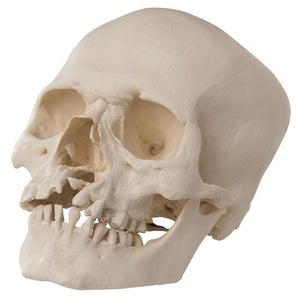 3B Scientific Human Skull Model with Cleft Jaw and Palate