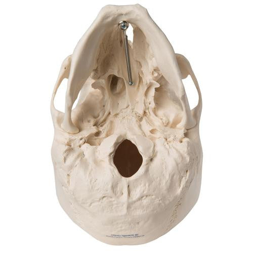 3B Scientific Human Skull Model with Cleft Jaw and Palate