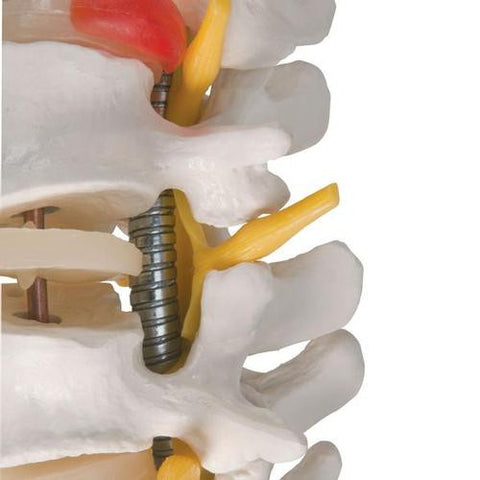 Image of 3B Scientific Highly Flexible Spine Model