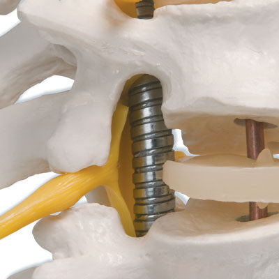 Image of 3B Scientific Highly Flexible Spine Model with Femur Heads