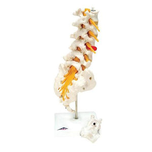 3B Scientific Lumbar Spinal Column with Dorso-Lateral Prolapsed Intervertebral Disc