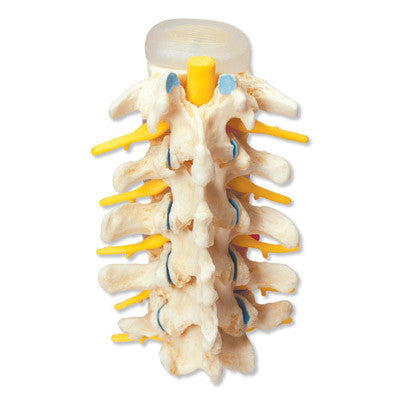 Image of 3B Scientific Stages of disc prolapse and vertebral degeneration