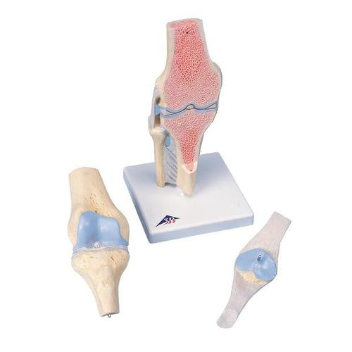 3B Scientific Sectional Knee Joint Model, 3 part