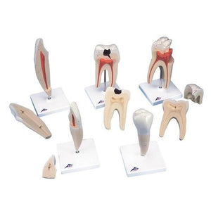 3B Scientific Classic Tooth Model Series, 5 models