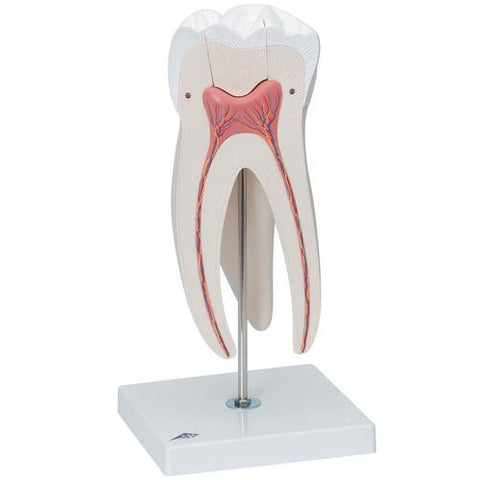 Image of 3B Scientific Giant Molar with Dental Cavities, 15 times life size, 5 part