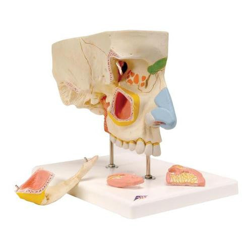 3B Scientific Nose Model with Paranasal Sinuses, 5 part