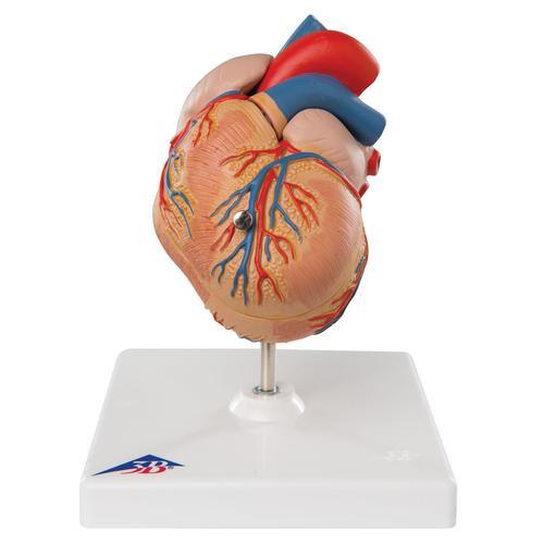 3B Scientific Classic Heart with Left Ventricular Hypertrophy (LVH), 2 part