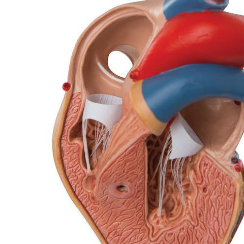 Image of 3B Scientific Classic Heart with Left Ventricular Hypertrophy (LVH), 2 part