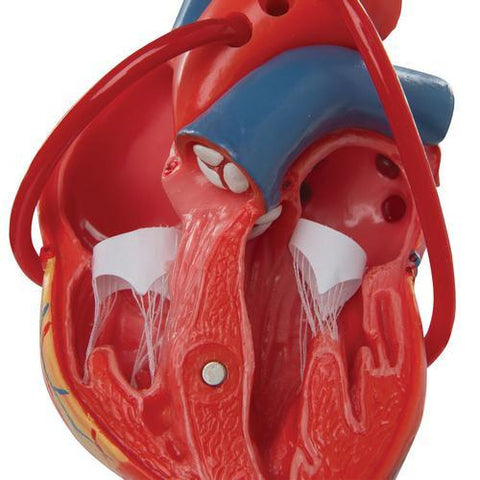 Image of 3B Scientific Classic Heart with Bypass, 2 part