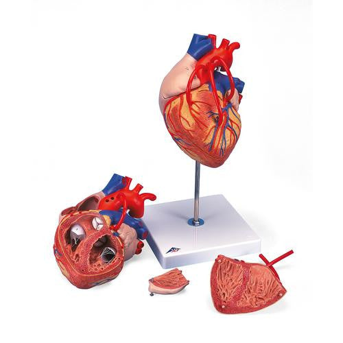 3B Scientific Heart with Bypass, 2 times life size, 4 part
