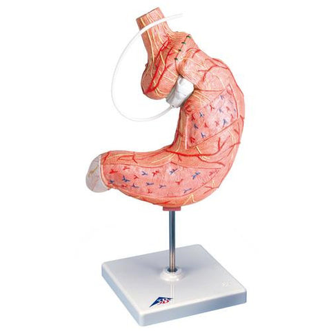 Image of 3B Scientific Gastric Band Model