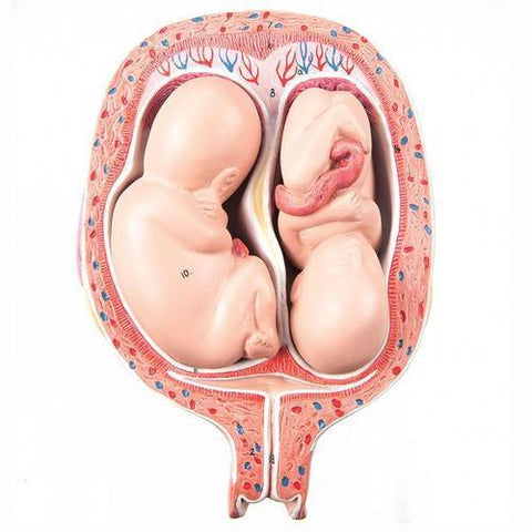 3B Scientific 5th Month Twin Fetuses - Normal Position