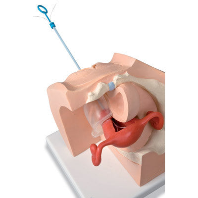 Image of 3B Scientific Model for Gynecological Patient Education