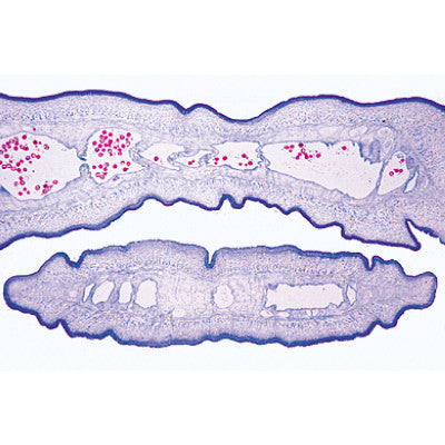 Image of 3B Scientific Vermes (Helminthes) - French Slides