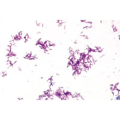 Image of 3B Scientific Bacteria, Basic Set - Spanish