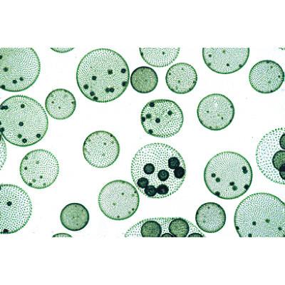 3B Scientific Algae - Spanish