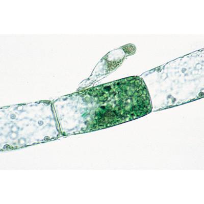 Image of 3B Scientific Algae - Spanish