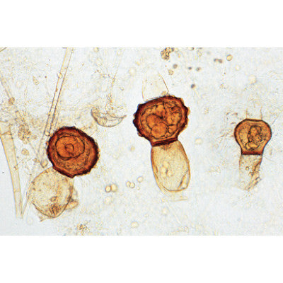 Image of 3B Scientific Fungi and Lichen - French