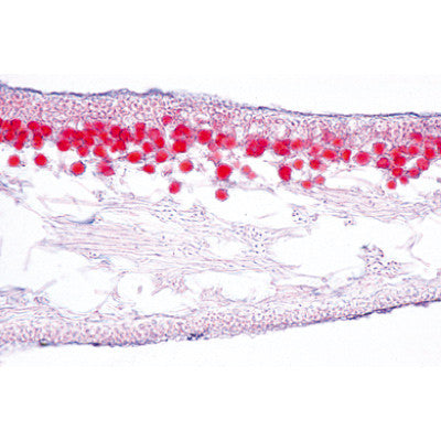 Image of 3B Scientific Fungi and Lichen - Spanish