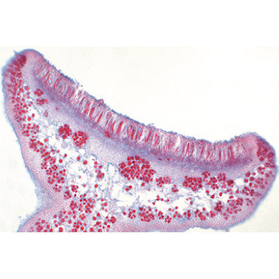 Image of 3B Scientific Fungi and Lichen - Spanish