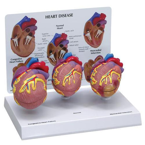 3B Scientific 3-Mini Heart Model Set