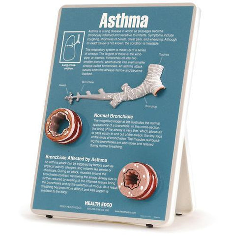 3B Scientific Asthma Easel Display