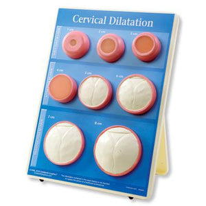 3B Scientific Cervical Dilation Easel Display
