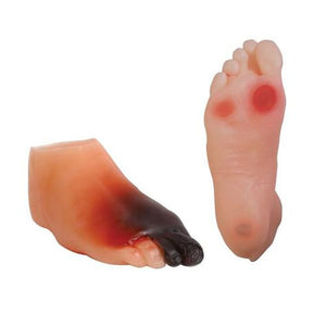 3B Scientific Diabetic Foot Model Set