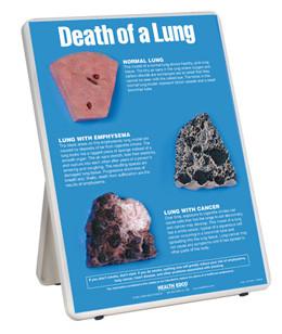 3B Scientific Death of a Lung Easel Display