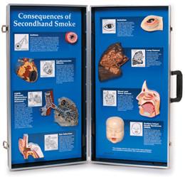 3B Scientific Consequences of Secondhand Smoke