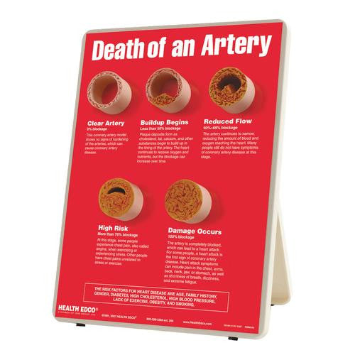 3B Scientific Death of An Artery Easel Display