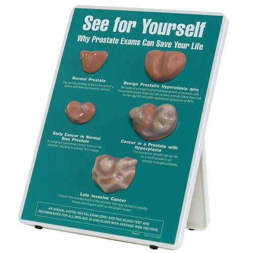 3B Scientific Why Prostate Exams Can Save Your Life Easel Display