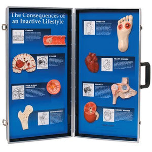 3B Scientific Consequences of An Inactive Lifestyle 3D Display