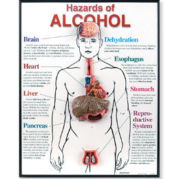 3B Scientific Hazards of Alcohol 3D Framed Chart