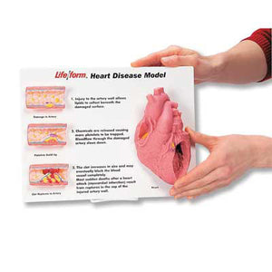3B Scientific Life/form® Heart Disease Display Kit