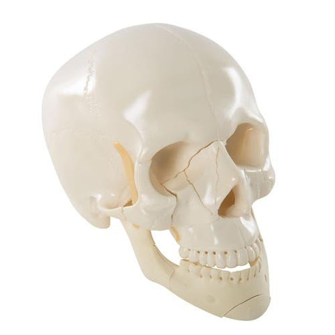 Image of 3B Scientific Skull with Multiple Fractures