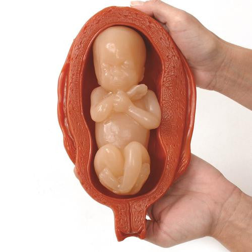 3B Scientific Uterus/Fetus Model Set (5)